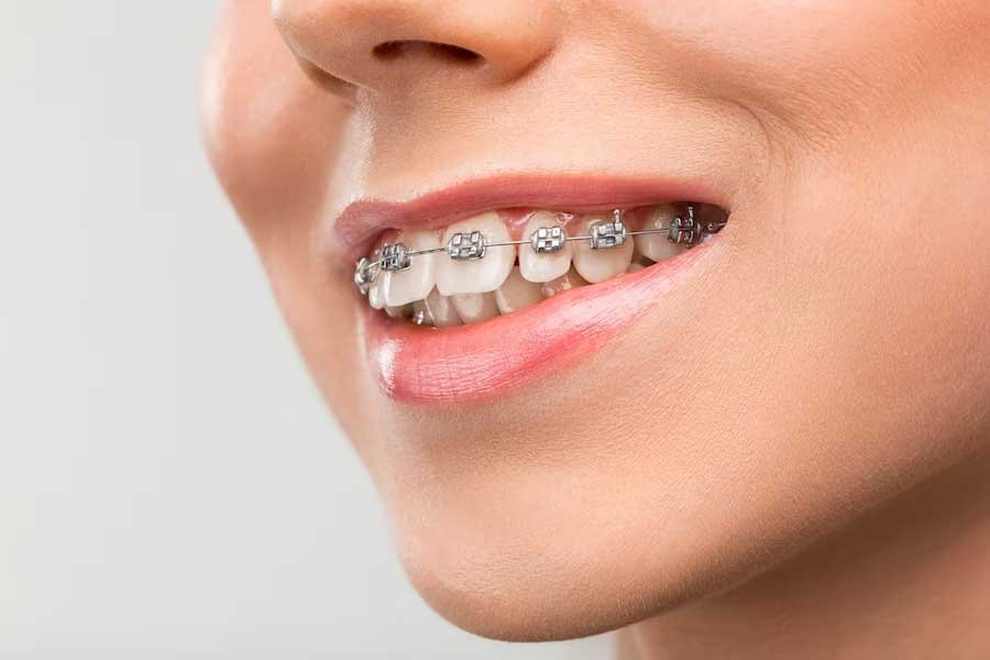 Braces Treatment Dubai Logo